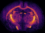 GalCer_d38-1_mz_754.62
